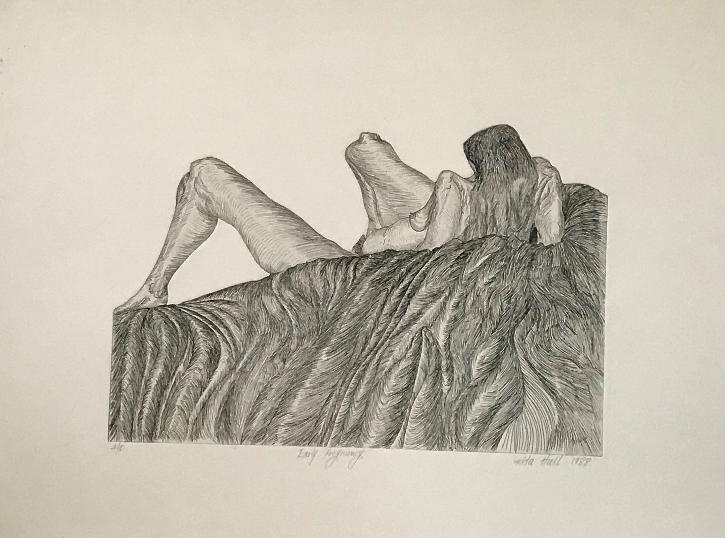 Early Pregnancy 1988 Etching 56 x 76cm